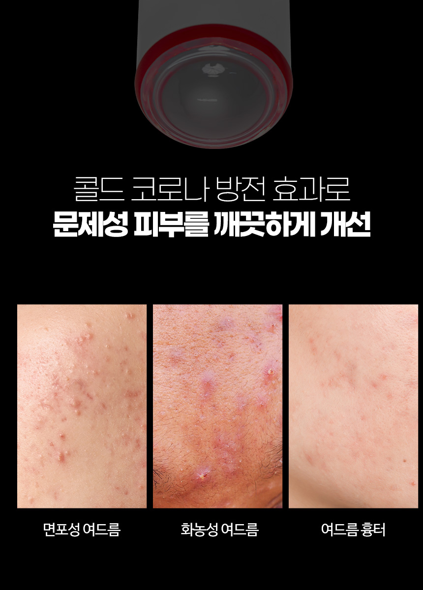 파우 스킨솔루션 SOS 플라즈마 AC제로 상세 안내 7